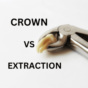 Read more about the article Crown vs Extraction – Which Dental Procedure is Right for You?
