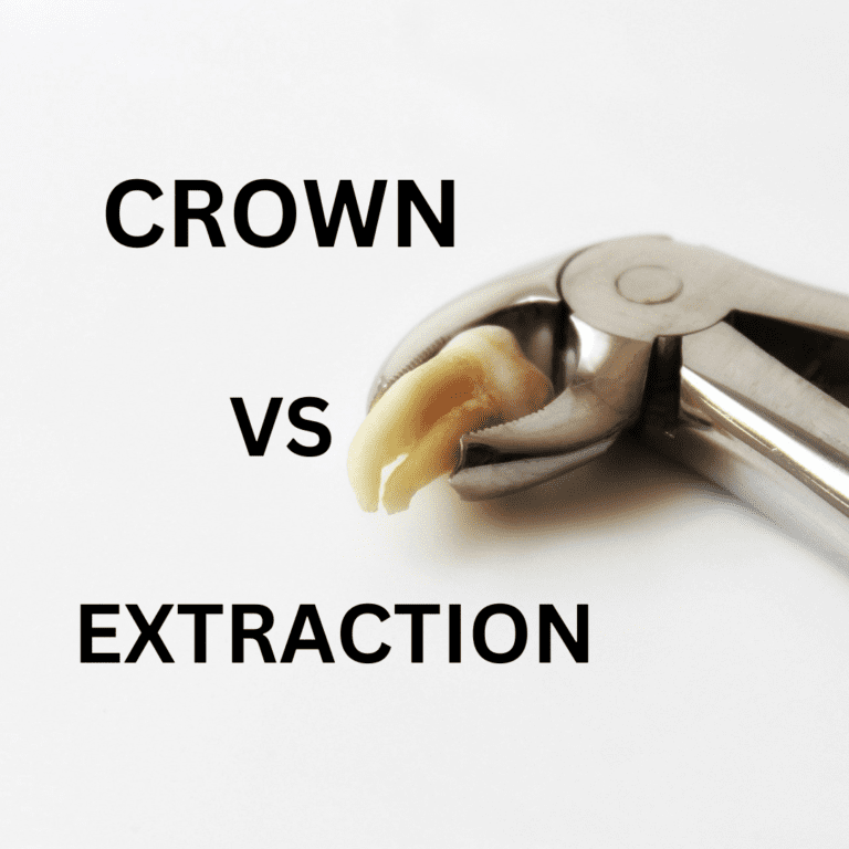 Dental forcep holding a tooth and text written as CROWN VS EXTRACTION.